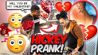 HICKEY PRANK ON MY GIRLFRIEND  GONE WRONG😰 [upl. by Fabi]