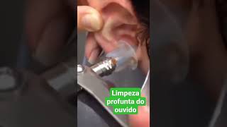 Lavagem do ouvido  Um lavagem profunda  PARTE 1 [upl. by Llesig]