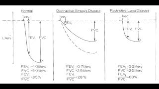 Obstructive vs Restrictive Lung Disease [upl. by Adnilem]