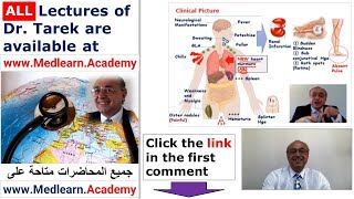 Subacute Bacterial Endocarditis SBE cme internalmedicine usmle medical ecg محاضراتباطنة [upl. by Lyrehc]