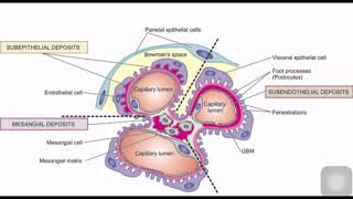 GLOMERULAR DEPOSITS [upl. by Irena]