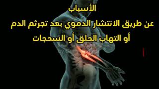 اسباب التهاب المفاصل البكتيري الحاد Causes of acute bacterial arthritis [upl. by Analaf]