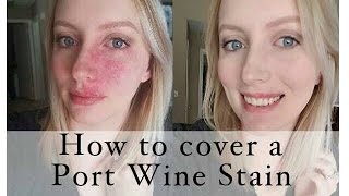 How to cover a Port Wine Stain birthmark [upl. by Ellimaj]