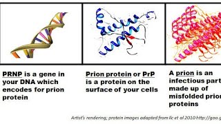 Prions  Prions Disease  Transmissible Spongiform Encephalopathies Diagnosis and treatment [upl. by Ahsatel]