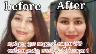 3 best pimples and Dark spots removel gel and face washsinhala [upl. by Anihpled666]