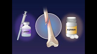 Aspirin vs LowMolecularWeight Heparin after a Fracture  NEJM [upl. by Ntsyrk]