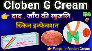 Cloben G Cream Uses in Hindi  Cloben cream use for Fungal infection  Skin disease Cream [upl. by Lobiv446]