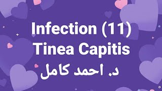 11 Tinea Capitis 👉 Fungal Infection by Dr Ahmed Kamel [upl. by Nellda]