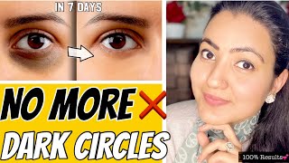 Remove DARK CIRCLES Permanently In 7 Days  100 Results [upl. by Adli]