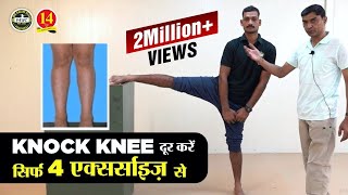 What is Knock Knee How to solve Knock Knee problem for Medical in Army Air Force and Navy [upl. by Alyks882]