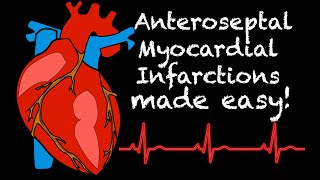 EMS Cardiology  Tachy Tuesday Anteroseptal Myocardial Infarction STEMI [upl. by Rafe250]