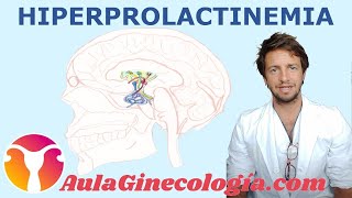 HIPERPROLACTINEMIA Causas telorrea diagnóstico y tratamiento  Ginecología y Obstetricia [upl. by Correna]