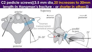 Atlantoaxial subluxation and dislocation [upl. by Darrill44]