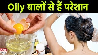 Learn How To Get Rid Of Oily Hair amp Scalp Naturally [upl. by Nerrej50]