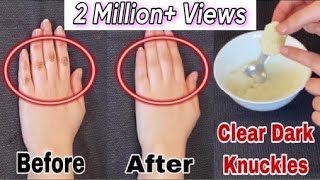 Do This Every Night For 7 Days To Lighten Dark Knuckles And Brighten Hands amp Feet  Faiqa Studio [upl. by Ariaic]