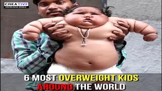 6 Most Overweight Kids Around The World [upl. by Karna511]