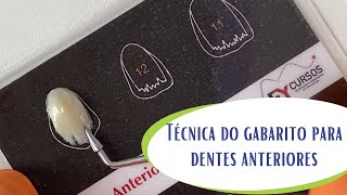 Técnica do Gabarito para Dentes Anteriores [upl. by Kim]