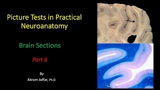 Picture Test in Neuroanatomy Brain Sections 6 [upl. by Sidhu]