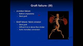 Treatment of Endoleaks When and How to Intervene  Norman Kumins MD [upl. by Aseeram]