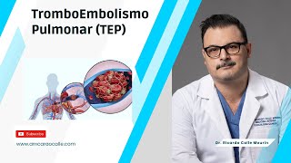 Tromboembolismo Pulmonar TEP  Signos y Síntomas  Complicaciones [upl. by Cordeelia]