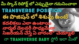 Transverse position during pregnancy transversebaby [upl. by Yereffej]