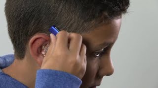 How to place Oticon Sensei BTE hearing aid with ear mould [upl. by Ijan602]