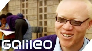 Albinos in Afrika  Galileo  ProSieben [upl. by Ahsikcin]