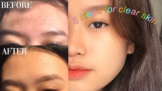 MY 5 BASIC STEPS FOR CLEAR SKIN 🍃✨ Philippines [upl. by Carmelita]