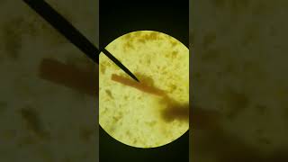 Microbiology Strongyloides stercoralis [upl. by Agrippina]