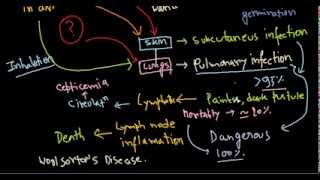 Bacillus anthracis infection [upl. by Raff]