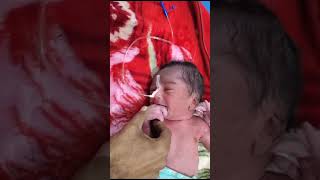 His body red Very special Cute Newborn Baby is delivered as breech with extremely flexible feet [upl. by Layap]