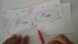 Inducible enzymes [upl. by Norrej649]