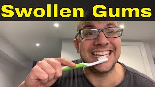 How To Reduce Swollen Gums At Home6 Easy Ways [upl. by Sobmalarah]