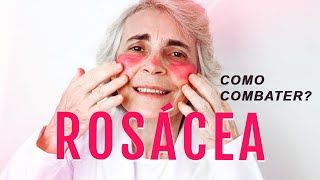 ROSÁCEA O que é Como cuidar Qual o Tratamento Dicas como combater e ficar livre [upl. by Maag]