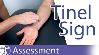 Tinel Sign Wrist  Carpal Tunnel Syndrome Diagnosis [upl. by Ainotal]