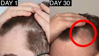 Copenhagen Grooming Hair Growth Results After 30 Days  Copenhagen Grooming Hair Growth Review [upl. by Howenstein]