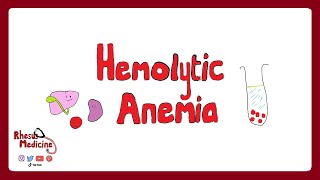 HEMOLYTIC ANEMIA Extravascular v Intravascular Clinical Features Diagnosis Coombs Test  Rhesus [upl. by Ronalda]