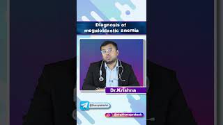 Diagnosis Of Megaloblastic Anemia  Quick Bites Internal medicine Hematology [upl. by Yecart]