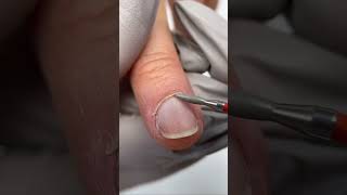 How to remove overgrown cuticles shorts [upl. by Theressa]