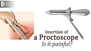 Purpose of proctoscopy How will a doctor insert a Proctoscope  Dr Rajasekhar M R [upl. by Cia122]