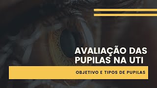 AVALIAÇÃO DAS PUPILAS NA UTI  QUAL O OBJETIVO E TIPOS DE PUPILAS [upl. by Eleaffar]