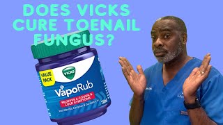 Does Vicks Cure Toenail Fungus [upl. by Phylis468]