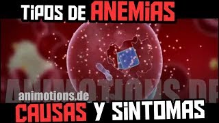 QUE ES LA ANEMIA  TIPOS SINTOMAS CAUSAS Y TRATAMIENTO [upl. by Hassi]