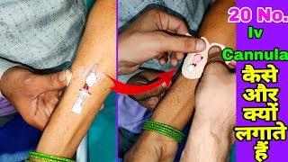 20 no Cannula kaise lagate hain🔥  how many types of cannula pink colour cannula pn [upl. by Branen]