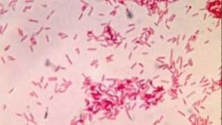 Fusobacterium and Infections [upl. by Assetan]