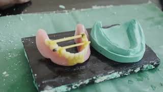 Denture Repair  Prosthodontics [upl. by Eicul838]