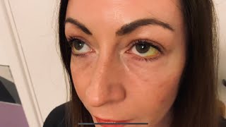 ASMR You’re an Ophthalmoscope [upl. by Dloraj446]