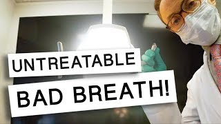 Bad Breath That CANT Be Treated [upl. by Ldnek]