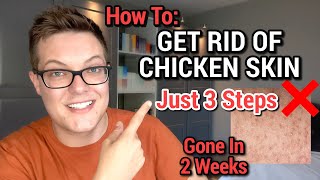 How To Get Rid Of Chicken Skin  KERATOSIS PILARIS SKINCARE ROUTINE [upl. by Dituri]