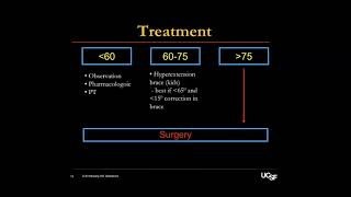 Scheuermann’s Kyphosis  Alekos Theologis MD on August 2 2024 [upl. by Nahaj]